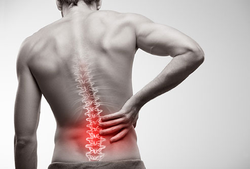 Bệnh đau nhức thắt lưng, nguyên nhân và cách điều trị hiệu quả